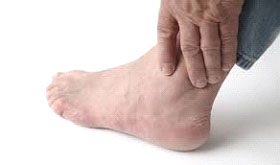 Causes of ankle bone spurs