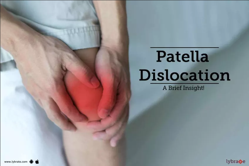 patella dislocation
