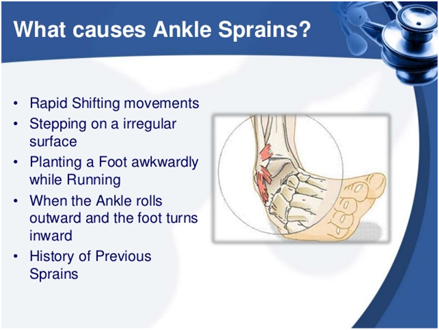 Causes of Ankle Sprain