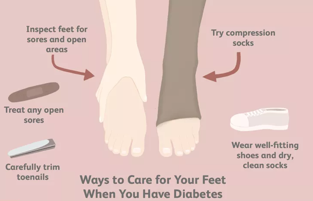 care for your feet
