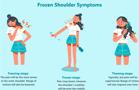 Symptoms of frozen shoulder