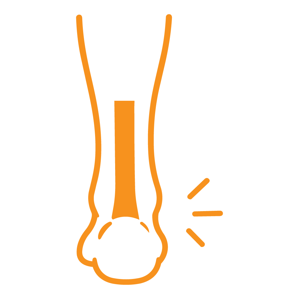 Icon Achilles tendonitis treatment