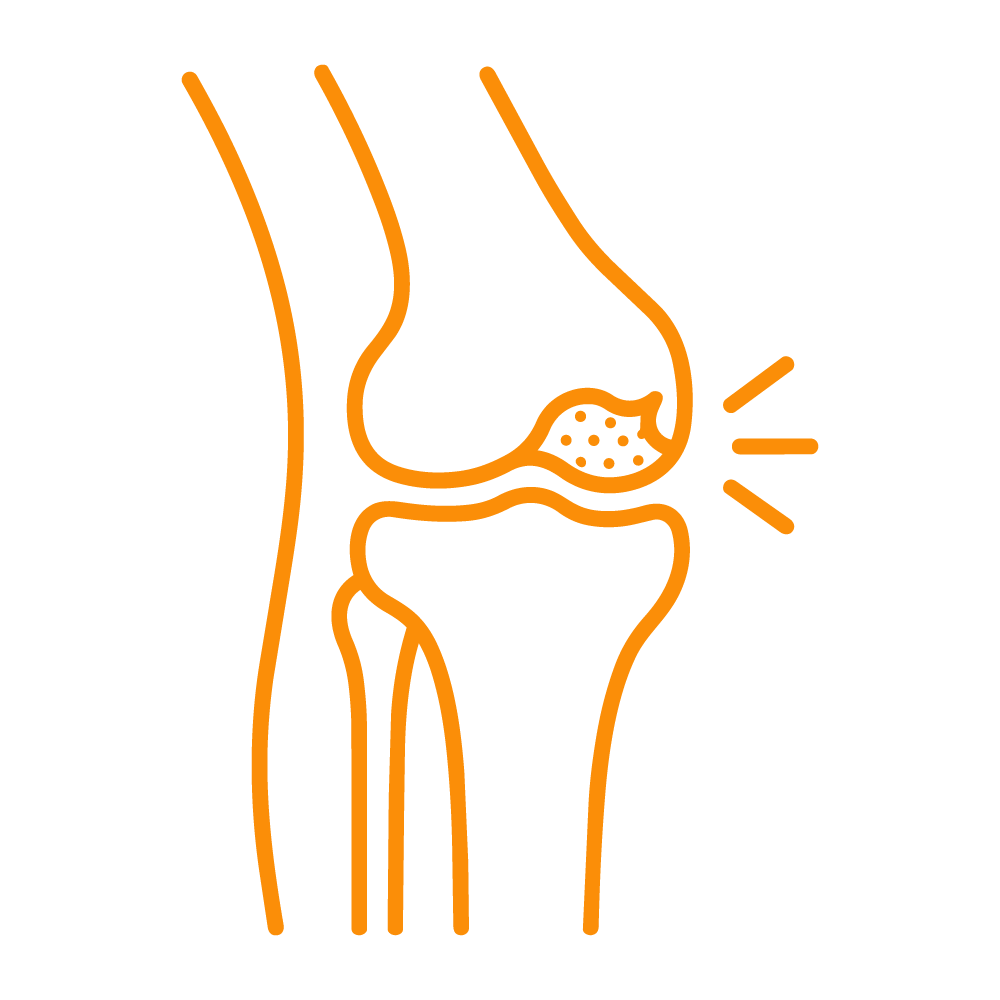Icon Cartilage damage