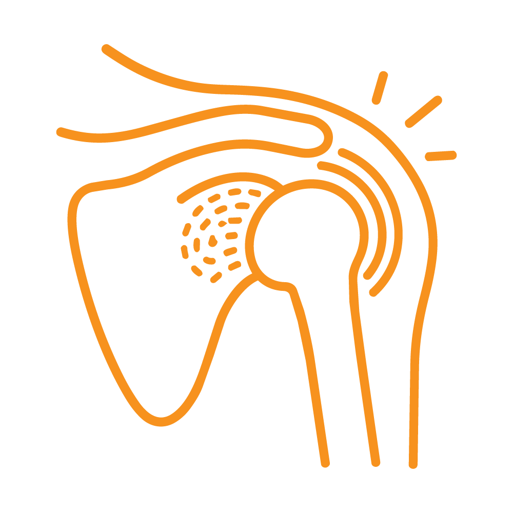 Icon Frozen shoulder