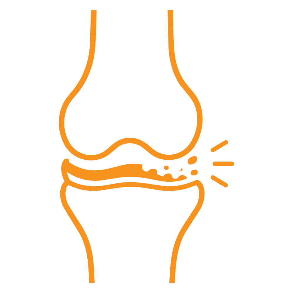 Icon Knee cartilage damage