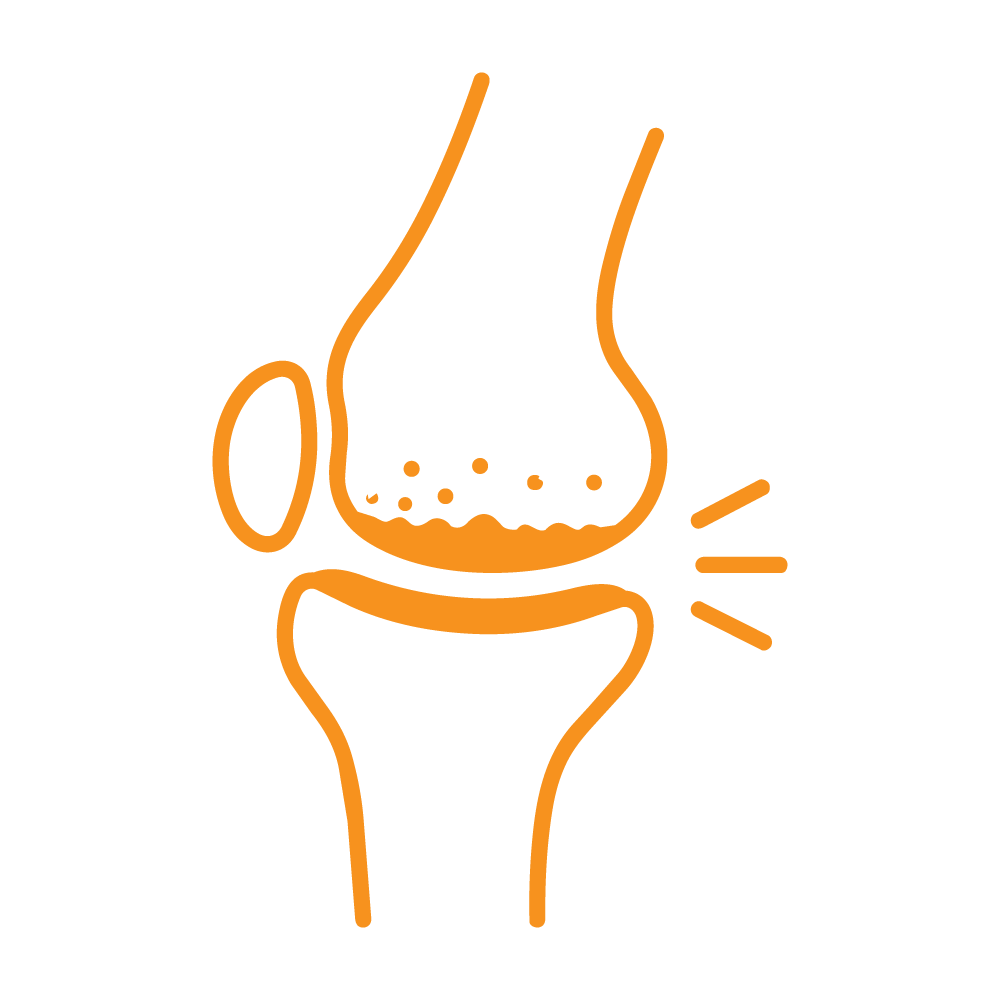 Icon Knee osteoarthritis