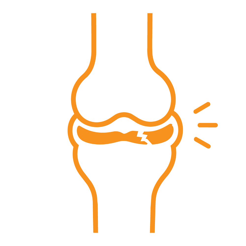 Icon Meniscus tear