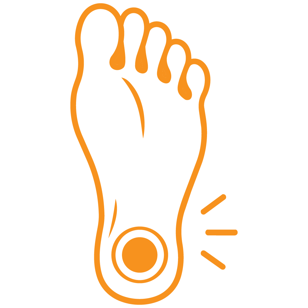 Icon Plantar fasciitis treatment