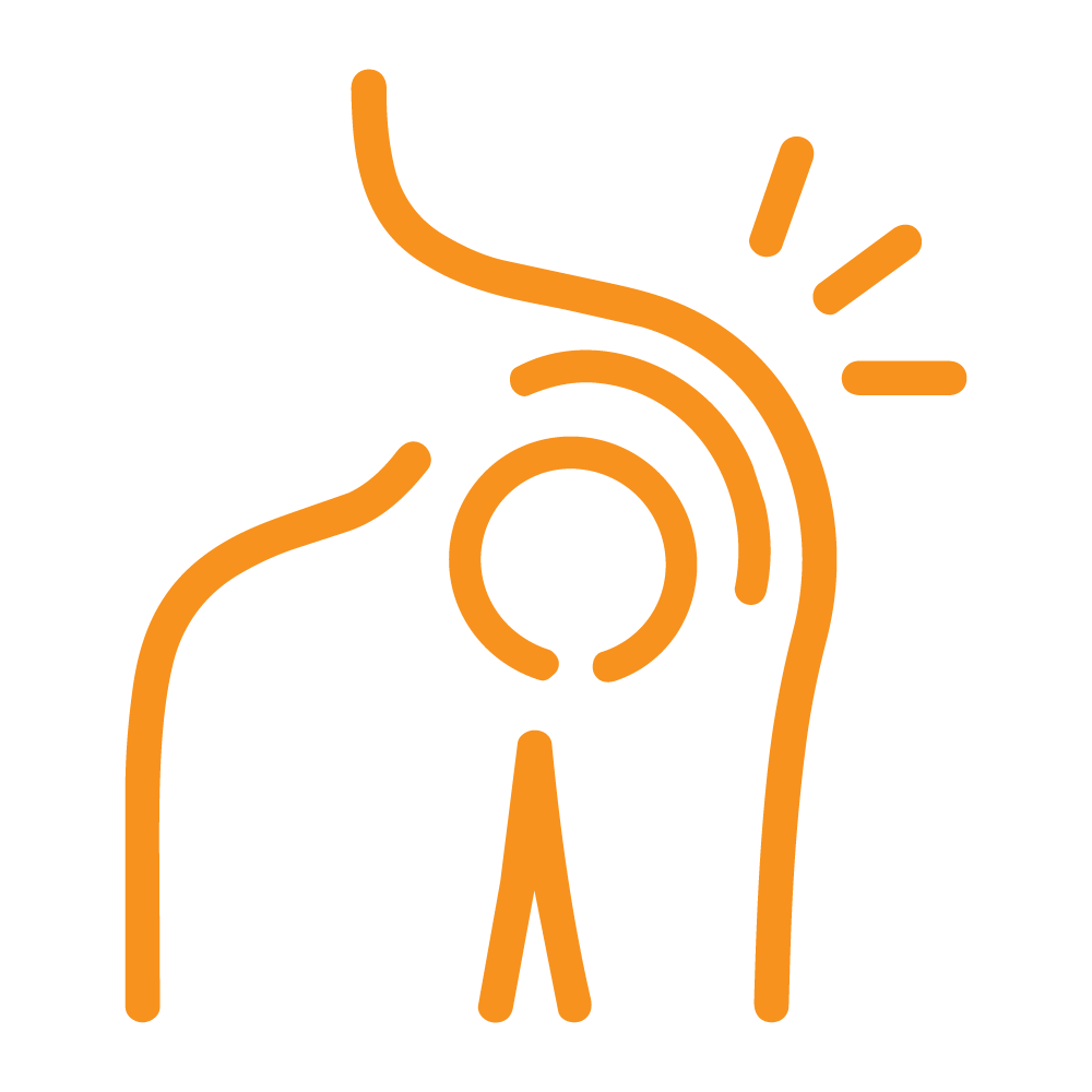 Icon Shoulder impingement