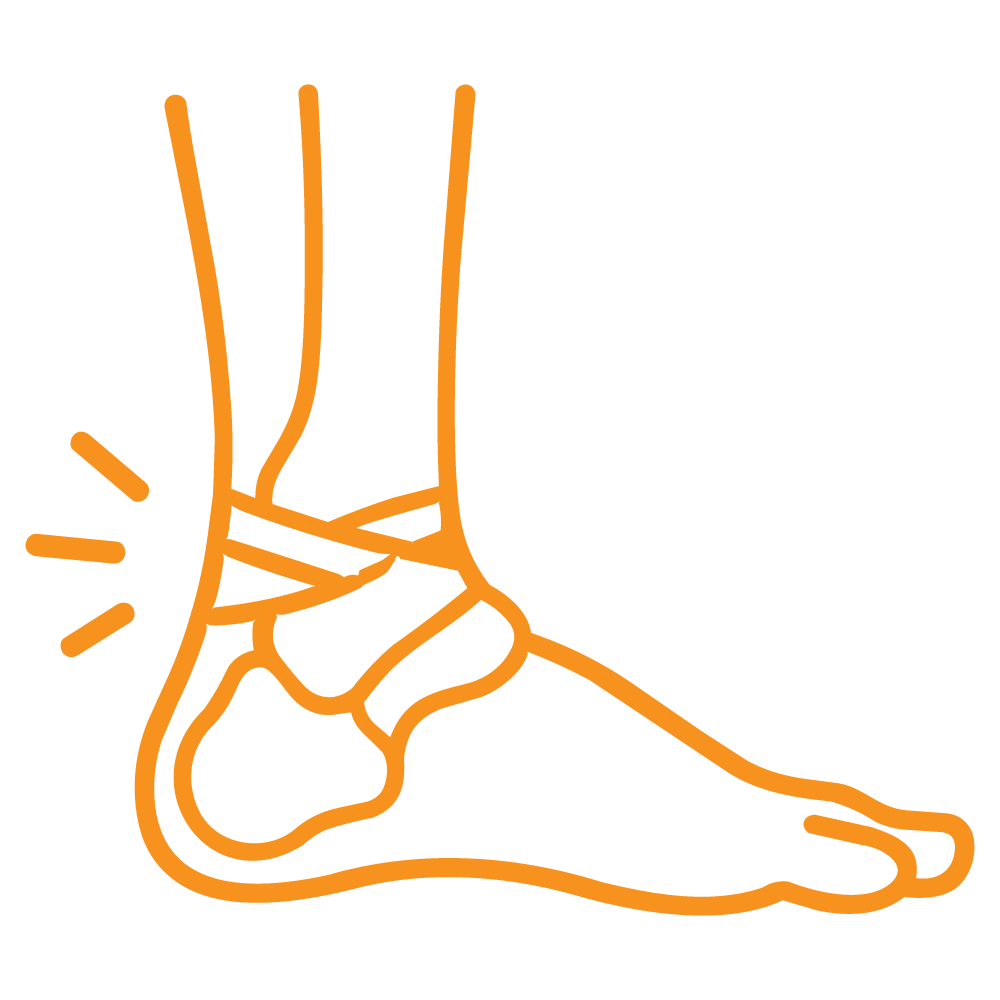 Icon Sprained ankle injuries